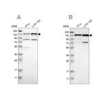 USP28 Antibody in Western Blot (WB)