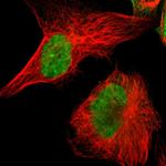 POGZ Antibody in Immunocytochemistry (ICC/IF)