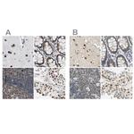 POGZ Antibody in Immunohistochemistry (IHC)