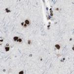 POGZ Antibody in Immunohistochemistry (IHC)