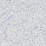 ThPOK Antibody in Immunohistochemistry (Paraffin) (IHC (P))