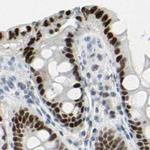 ThPOK Antibody in Immunohistochemistry (IHC)