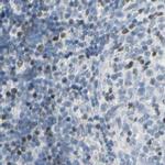 ThPOK Antibody in Immunohistochemistry (IHC)