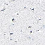 ThPOK Antibody in Immunohistochemistry (IHC)