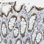 ThPOK Antibody in Immunohistochemistry (IHC)