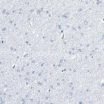 VAMP8 Antibody in Immunohistochemistry (IHC)