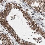 SLC27A3 Antibody in Immunohistochemistry (Paraffin) (IHC (P))