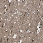 RAB7 Antibody in Immunohistochemistry (IHC)