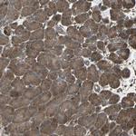 RAB7 Antibody in Immunohistochemistry (IHC)