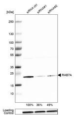 RAB7 Antibody in Western Blot (WB)