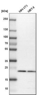 RAB7 Antibody in Western Blot (WB)