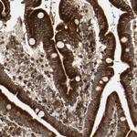 Tapasin Antibody in Immunohistochemistry (IHC)