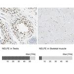 RDBP Antibody in Immunohistochemistry (IHC)