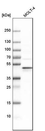 RDBP Antibody in Western Blot (WB)