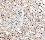 ALKBH5 Antibody in Immunohistochemistry (IHC)