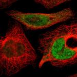 KANSL1 Antibody in Immunocytochemistry (ICC/IF)