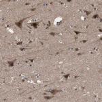 KANSL1 Antibody in Immunohistochemistry (Paraffin) (IHC (P))