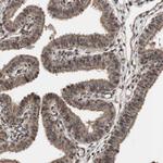 KANSL1 Antibody in Immunohistochemistry (Paraffin) (IHC (P))