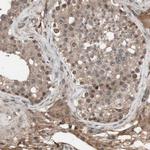 KANSL1 Antibody in Immunohistochemistry (Paraffin) (IHC (P))