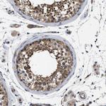 CRCP Antibody in Immunohistochemistry (Paraffin) (IHC (P))