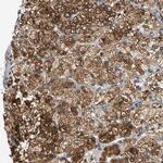 CNST Antibody in Immunohistochemistry (Paraffin) (IHC (P))