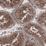 LSR Antibody in Immunohistochemistry (IHC)