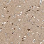 USP46 Antibody in Immunohistochemistry (Paraffin) (IHC (P))