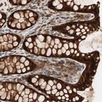 GALE Antibody in Immunohistochemistry (Paraffin) (IHC (P))