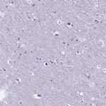 MFAP2 Antibody in Immunohistochemistry (Paraffin) (IHC (P))