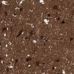 cGKII Antibody in Immunohistochemistry (Paraffin) (IHC (P))