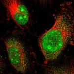 RCOR3 Antibody in Immunocytochemistry (ICC/IF)