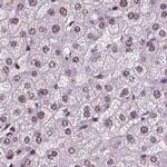 RCOR3 Antibody in Immunohistochemistry (IHC)