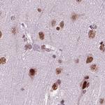 RCOR3 Antibody in Immunohistochemistry (IHC)