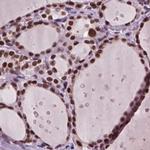 RCOR3 Antibody in Immunohistochemistry (IHC)