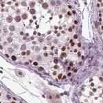 RCOR3 Antibody in Immunohistochemistry (IHC)