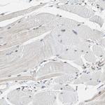 WWTR1 Antibody in Immunohistochemistry (IHC)