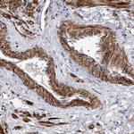 SPOCK1 Antibody in Immunohistochemistry (IHC)