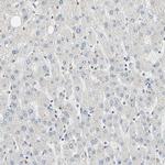 WIPI1 Antibody in Immunohistochemistry (Paraffin) (IHC (P))