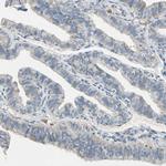 WIPI1 Antibody in Immunohistochemistry (IHC)