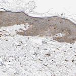 P4HA1 Antibody in Immunohistochemistry (Paraffin) (IHC (P))