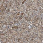 P4HA1 Antibody in Immunohistochemistry (IHC)