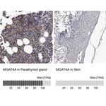 MGAT4A Antibody in Immunohistochemistry (IHC)