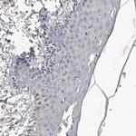 MGAT4A Antibody in Immunohistochemistry (IHC)