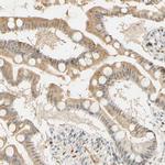 MEKK4 Antibody in Immunohistochemistry (Paraffin) (IHC (P))