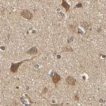 MRPS22 Antibody in Immunohistochemistry (IHC)