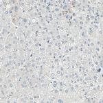 Brevican Antibody in Immunohistochemistry (Paraffin) (IHC (P))