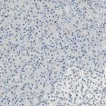 Brevican Antibody in Immunohistochemistry (Paraffin) (IHC (P))