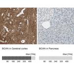 Brevican Antibody in Immunohistochemistry (IHC)