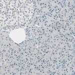 Brevican Antibody in Immunohistochemistry (IHC)