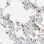 ABCA3 Antibody in Immunohistochemistry (IHC)